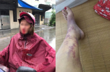 Cay đắng vợ nuôi chồng từ thuở khó khăn, đến khi giàu sang chồng lại đánh vợ đổ máu, ngoại tình