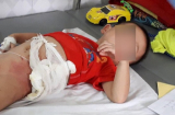 Bé trai 5 tuổi bất ngờ bị bác ruột thẳng tay ném vào bếp lửa, nguyên nhân mới khiến mọi người bất ngờ