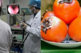 Cảnh báo sau vụ: Dạ dày có 10 viên sỏi to bằng quả trứng vì ăn loại quả nhiều người thích