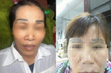 Đi làm đẹp, người phụ nữ cay đắng nhận về cặp lông mày 'tân dòng sông ly biệt' để đời