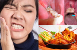 NHỔ RĂNG KHÔN chớ có quên NHỮNG ĐIỀU KIÊNG KỴ NÀY kẻo có ngày hối hận