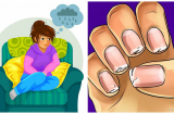 7 dấu hiệu cảnh báo Sh88bet đăng ký miễn phí thiếu canxi trầm trọng, rất nhiều người Việt vẫn cố tình cho qua