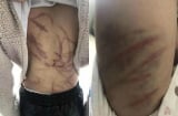 Thấy bé gái 10 tuổi chạy sang nhà kêu đau đớn, người hàng xóm kiểm tra thì phát hiện chuyện 'động trời'