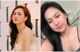 Phương Anh Đào bị nghi đụng chạm 'dao kéo' vì mặt sưng khác lạ?