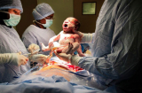 Ám ảnh sau sinh mổ đau đớn thế này: Chị em share về để chồng yêu vợ đọc và yêu thương vợ hơn nhé