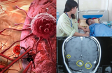 Cẩn trọng với những 'điềm báo' này kẻo đi khám thì đã bị ung thư, đến bác sĩ cũng lắc đầu