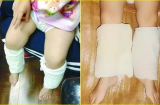 Con sốt mẹ buộc khăn bắp chân khiến ai cũng thấy kỳ lạ nhưng hiệu quả lại vô cùng bất ngờ