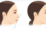 Đàn bà nhìn tướng cằm 2 giây biết ngay giàu - nghèo, phúc - họa 1 đời: Đúng đến khó tin!