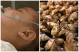 Cậu bé 2 tuổi phải sống thực vật vì sai lầm của người lớn, cha mẹ hối hận thì đã muộn