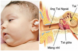 Sai lầm trong điều trị viêm tai giữa khiến bệnh tình của trẻ tăng nặng, mẹ thông thái nhớ đừng mắc phải