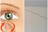 Đột nhiên thấy dấu hiệu này xuất hiện: Cẩn trọng tai họa đổ xuống đầu sức khỏe suy giảm, tiền bạc tiêu tán