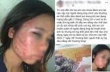 Cô vợ bầu 7 tháng bị chồng nhẫn tâm đánh đập không thương tiếc nhưng điều này mới khiến nhiều người xót thương