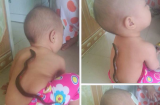Hạ sốt bằng lươn tưởng hiệu quả ai ngờ con còn nhiễm bệnh nặng hơn: Mẹ thông thái chớ dại rước họa vào thân