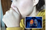 Cô gái 21 tuổi chỉ sống được 5 ngày sau khi phát hiện ung thư vì bỏ qua duy nhất 1 dấu hiệu này