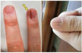 Thấy bàn tay có 1 trong 4 dấu hiệu này: Đi khám ngay vì Sh88bet đăng ký miễn phí đang cảnh báo bệnh nguy hiểm
