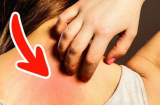 5 thay đổi trên da ''tố cáo'' Sh88bet đăng ký miễn phí mắc bệnh nguy hiểm, chớ để lâu kẻo hối hận không kịp