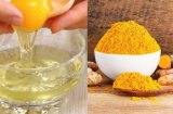 Sạch mụn, sáng da với 3 cách làm mặt nạ trị mụn bằng trứng gà tại nhà