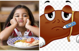 4 thói quen xấu khiến bé mắc bệnh gan nhưng nhiều bà mẹ vẫn lơ là