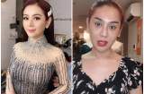 Mặc kệ lời đàm tiếu về gương mặt sần sùi, Lâm Khánh Chi vẫn tự tin khẳng định mình đẹp