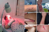 Cô gái ngoại quốc bị người phụ nữ đánh đập rồi cắn vào mặt trong nhà vệ sinh, nguyên nhân mới khiến bất ngờ