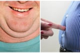 Cảnh báo: 2 bộ phận Sh88bet đăng ký miễn phí nam giới to hơn bình thường là dấu hiệu của căn bệnh nguy hiểm, chớ coi thường