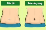 Nhìn tướng rốn biết người phụ nữ chân tình hay lả lơi: Mệnh phượng hoàng tiểu thư hay nô tì trọn kiếp