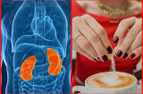 Điểm mặt 4 loại thực phẩm khoái khẩu của người Việt gây suy thận nhanh chóng, càng ăn càng nhanh đi chạy thận