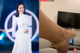 Mai Phương Thúy bị đau chân khi đi đôi giày cao 15cm ((30/7))