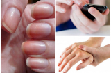Nhìn vào ngón tay thấy có dấu hiệu này hãy nghĩ ngay tới căn bệnh nguy hiểm, đề phòng không thừa