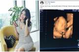 Vợ chồng Lan Khuê hạnh phúc bật mí giới tính con đầu lòng