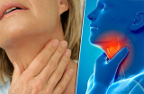 Cảnh báo thói quen 'đón' ung thư vào người, nhiều người biết nhưng vẫn cố tình làm