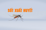 Sốt xuất huyết nên kiêng ăn gì để nhanh khỏi?