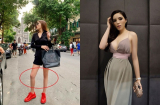 Kỳ Duyên gây hoang mang khi để lộ chân bên to bên bé