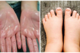 Thấy 4 dấu hiệu này trên Sh88bet đăng ký miễn phí, hãy đi khám ngay kẻo quá muộn