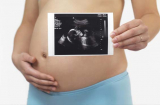 Cách đọc chỉ số siêu âm thai chuẩn xác nhất, mẹ bầu nào cũng cần biết