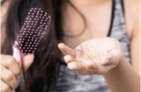 Bỏ túi mẹo nhỏ giúp tóc không bị rụng trong thời tiết giao mùa