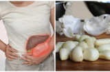 5 điều tối kị khi ăn tỏi gây hại cho nội tạng, rất nhiều người vẫn mắc mà không hề biết