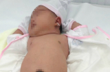 Bé gái chào đời với cân nặng 5,2kg đến y bác sĩ cũng phải bất ngờ