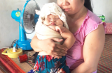 Bé gái sơ sinh 4,1kg bị bác sĩ kéo đứt dây chằng tay, để lại di chứng suốt đời