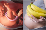 3 lý do mẹ bầu nên ăn chuối mỗi ngày, vừa tốt cho mẹ lại giúp con khỏe mạnh cao lớn
