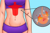 Những vị trí đau 'tiết lộ' căn bệnh nguy hiểm đang chuẩn bị kéo đến, chớ dại mà coi thường