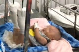 Cha ruột đánh con trai 4 tháng tuổi gãy chân, xuất huyết não chỉ vì bé khóc không chịu nín