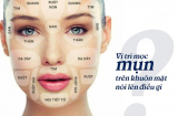 'Đoán bệnh' qua 5 vị trí nổi mụn trên khuôn mặt
