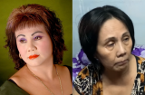 Nghệ sĩ Hoàng Lan bị hỏng cột sống và mắt phải, có nguy cơ đóng cửa quán ăn vì vắng khách