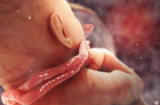 4 kiểu mẹ nên đẻ mổ để đảm bảo an toàn cho con