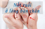 Vị trí nốt ruồi ở bàn chân đích thị là 'thủ phạm' khiến bạn nghèo trọn kiếp, cố mãi cũng không thể giàu