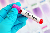 Việt Nam vừa ghi nhận 1 trường hợp mắc bệnh do virus Zika gây bệnh đầu nhỏ