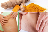 3 cách chữa rạn da sau sinh bằng nghệ, mẹ bầu nào cũng nên biết