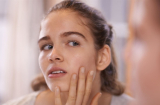 Hè này bạn cần học các bí kíp để da luôn căng mịn, láng bóng đúng chuẩn glass skin
