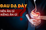 7 thực phẩm là 'sát thủ' của Shbet123 Link Vào ShBet Mới Nhất, món thứ 2 nhiều người 'mê'